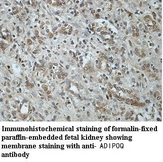 ADIPOQ antibody (pAb)