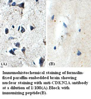 CDKN2A antibody (pAb) CDKN2A antibody (pAb)