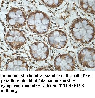 TNFRSF13B antibody (pAb)