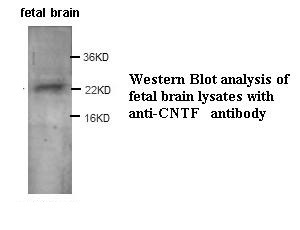 CNTF antibody (pAb) CNTF antibody (pAb)