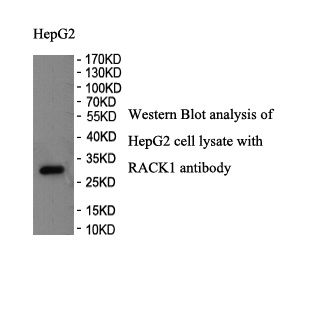 RACK1 antibody (pAb) RACK1 antibody (pAb)