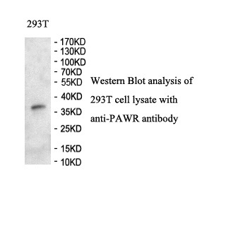 PAWR antibody (pAb) PAWR antibody (pAb)