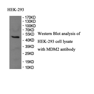 MDM2 antibody (pAb) MDM2 antibody (pAb)