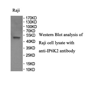 IP6K2 antibody (pAb)