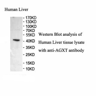AGXT antibody (pAb) AGXT antibody (pAb)