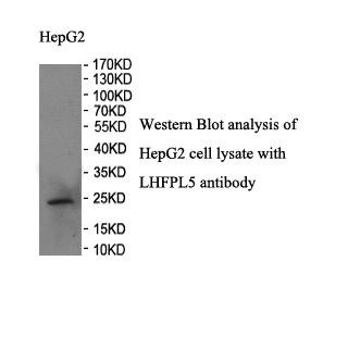 LHFPL5 antibody (pAb) LHFPL5 antibody (pAb)