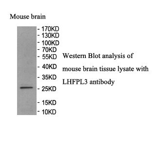 LHFPL3 antibody (pAb) LHFPL3 antibody (pAb)