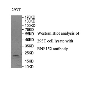 RNF152 antibody (pAb) RNF152 antibody (pAb)