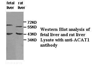 SOAT1 antibody (pAb)