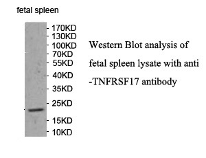 TNFRSF17 antibody (pAb)