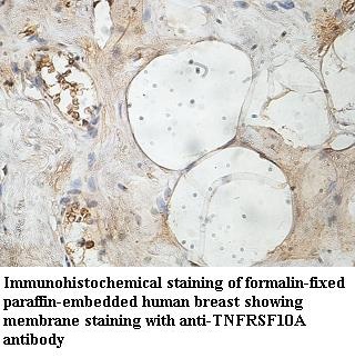 TNFRSF10A antibody (pAb) TNFRSF10A antibody (pAb)
