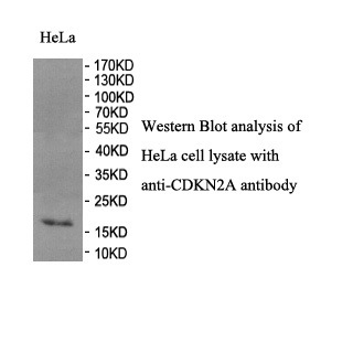 CDKN2A antibody (pAb) CDKN2A antibody (pAb)