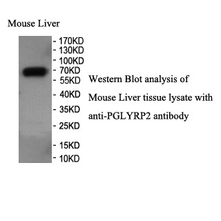 PGLYRP2 antibody (pAb) PGLYRP2 antibody (pAb)