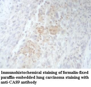 Cas9 antibody (pAb) Cas9 antibody (pAb)