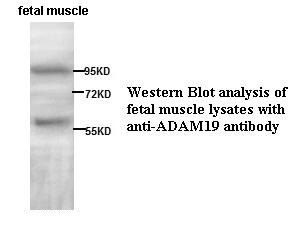 ADAM19 antibody (pAb)