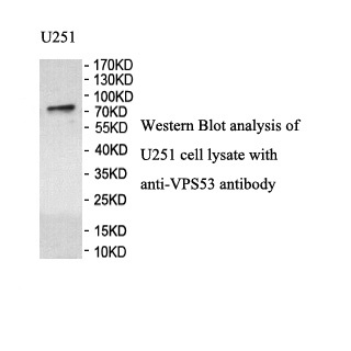 VPS53 antibody (pAb) VPS53 antibody (pAb)