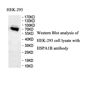 HSPA1B antibody (pAb) HSPA1B antibody (pAb)