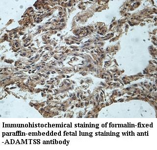ADAMTS8 antibody (pAb)