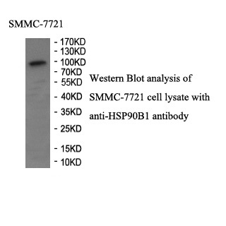 HSP90B1 antibody (pAb) HSP90B1 antibody (pAb)