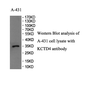KCTD4 antibody (pAb) KCTD4 antibody (pAb)