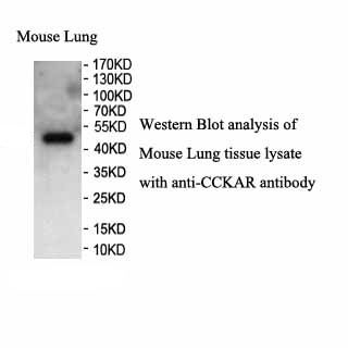CCKAR antibody (pAb) CCKAR antibody (pAb)