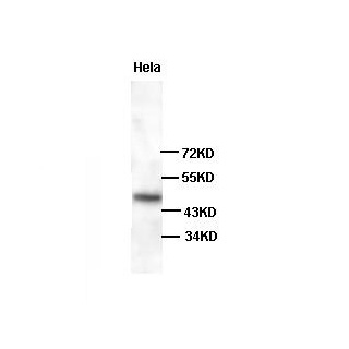 TRIM13 antibody (pAb) TRIM13 antibody (pAb)