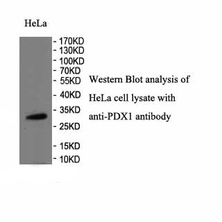 PDX1 antibody (pAb) PDX1 antibody (pAb)