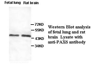 PAX6 antibody (pAb) PAX6 antibody (pAb)
