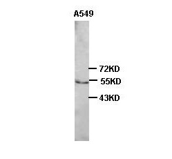 TNFRSF10B antibody (pAb) TNFRSF10B antibody (pAb)