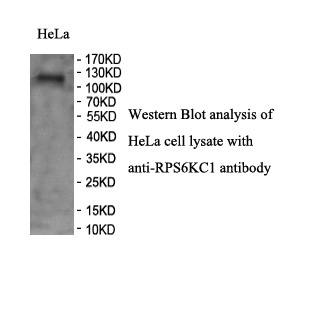 RPS6KC1 antibody (pAb)