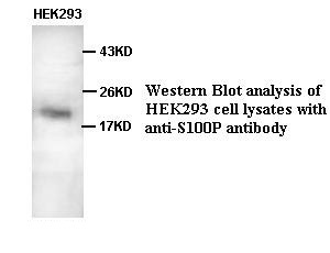 S100P antibody (pAb) S100P antibody (pAb)