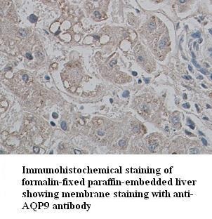AQP9 antibody (pAb)