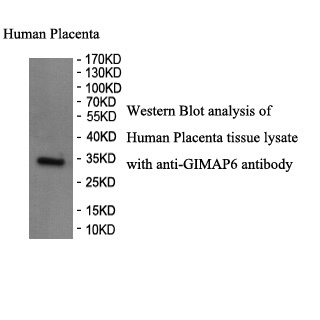 GIMAP6 antibody (pAb) GIMAP6 antibody (pAb)