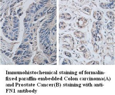 FN1 antibody (mAb) FN1 antibody (mAb)