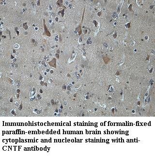 CNTF antibody (pAb) CNTF antibody (pAb)