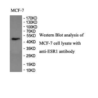 ESR1 antibody (pAb) ESR1 antibody (pAb)