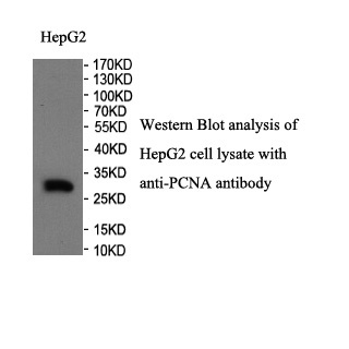 PCNA antibody (pAb) PCNA antibody (pAb)