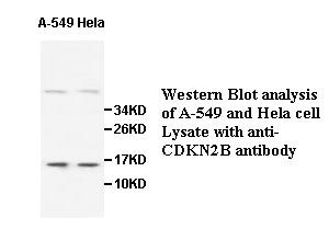 CDKN2B antibody (pAb) CDKN2B antibody (pAb)
