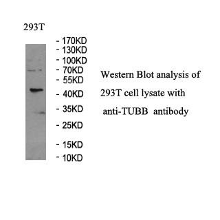 TUBB antibody (pAb) TUBB antibody (pAb)