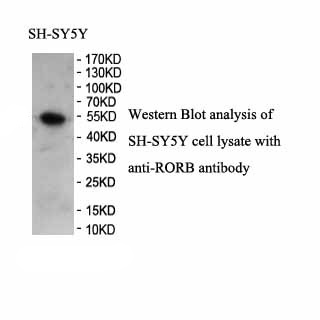 RORB antibody (pAb)