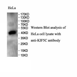 KIF5C antibody (pAb) KIF5C antibody (pAb)