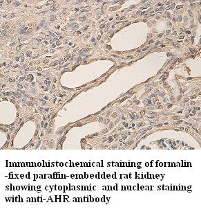 AHR antibody (pAb) AHR antibody (pAb)