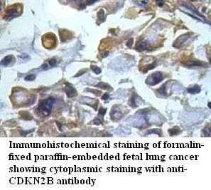 CDKN2B antibody (pAb) CDKN2B antibody (pAb)
