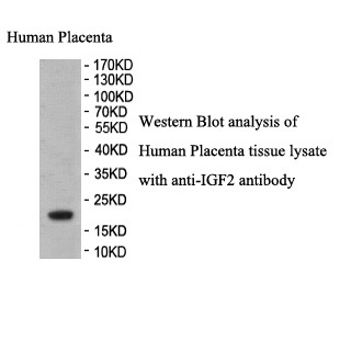 IGF2 antibody (pAb) IGF2 antibody (pAb)