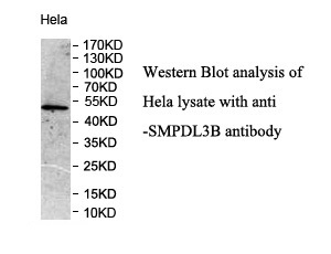 SMPDL3B antibody (pAb) SMPDL3B antibody (pAb)