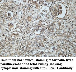 TRAP1 antibody (pAb) TRAP1 antibody (pAb)