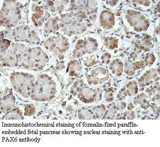 PAX6 antibody (pAb) PAX6 antibody (pAb)