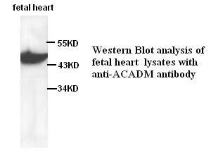 ACADM antibody (pAb)