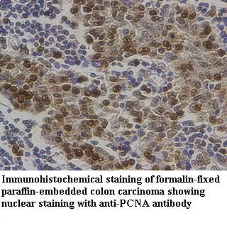 PCNA antibody (pAb) PCNA antibody (pAb)