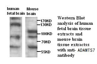 ADAMTS7 antibody (pAb)